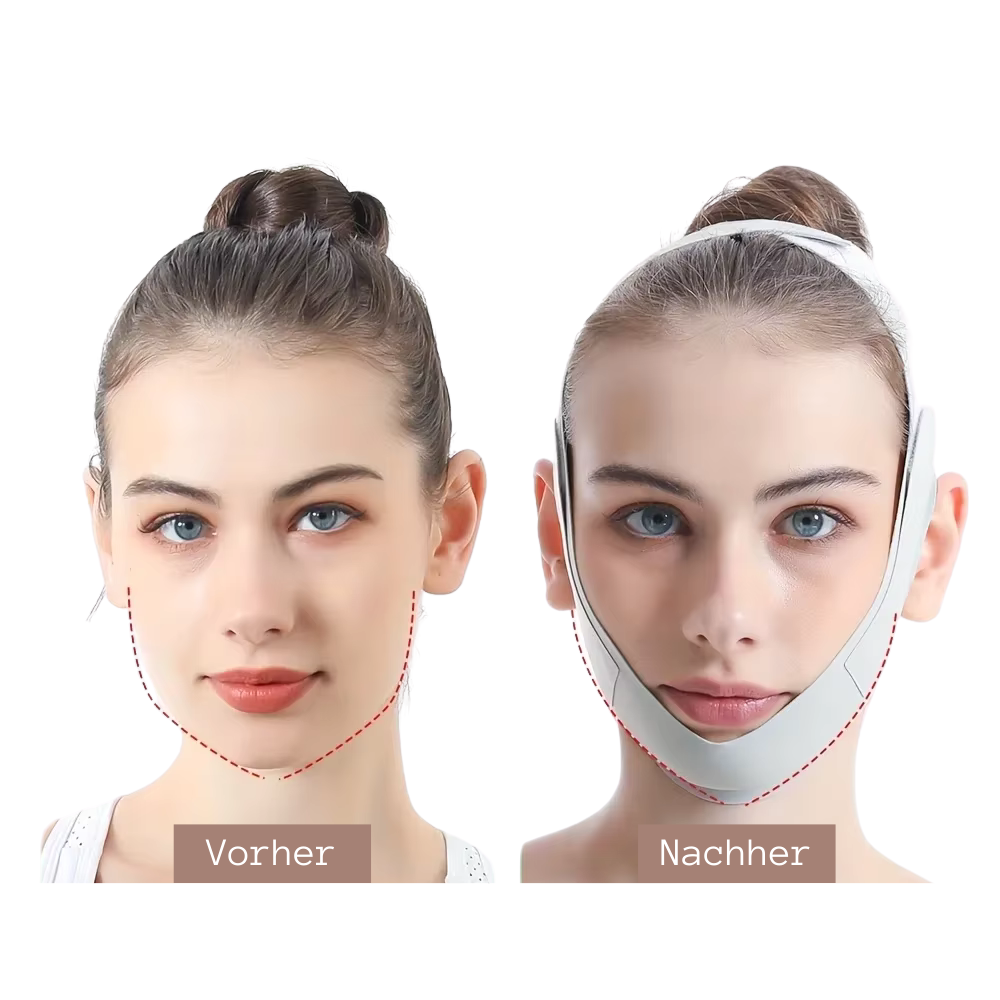 Vorher-Nachher-Ergebnis mit novura V-Lift-Maske – sichtbar straffere Haut